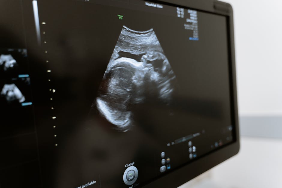 This Is How to Become an Ultrasound Technician